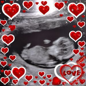 Meet your Posher, Starr